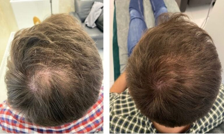 Before After