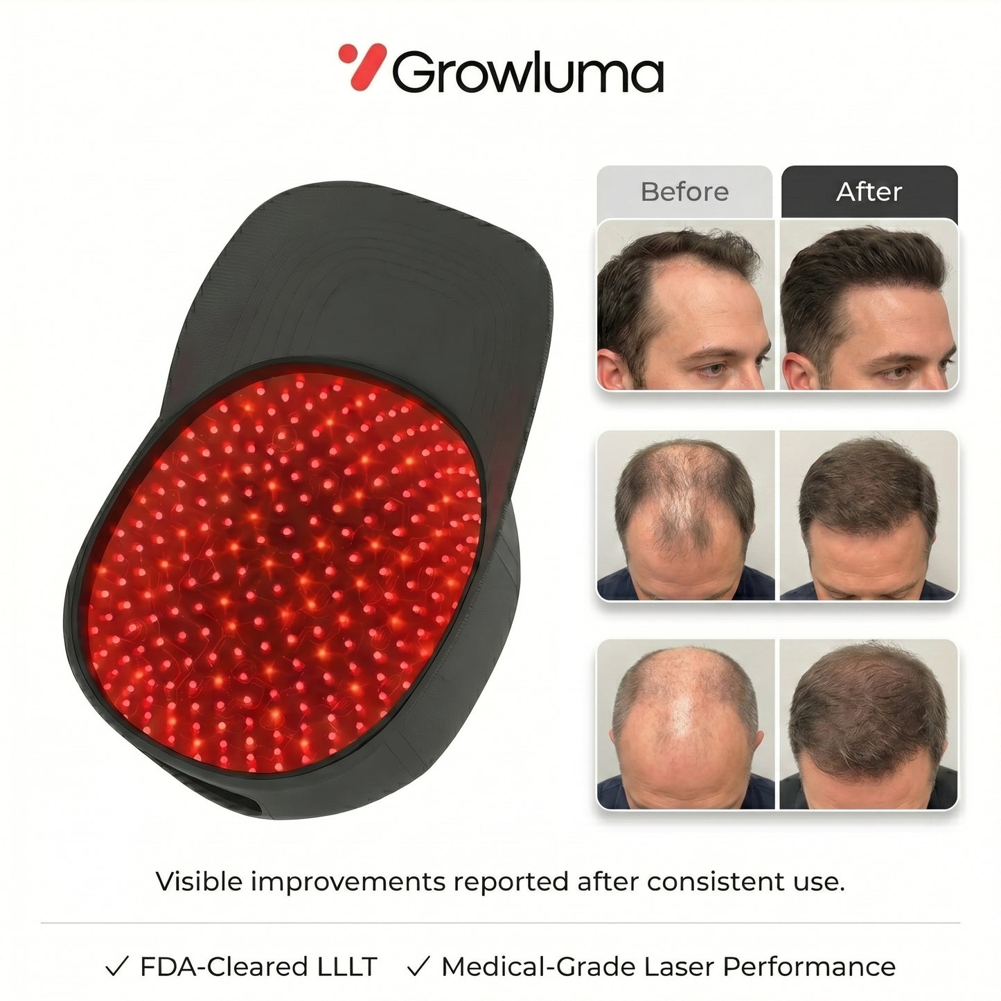 GrowLuma Hair Growth Cap 120
